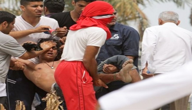 اصابة 3 متظاهرين في اطلاق غاز مسيل للدموع في البحرين