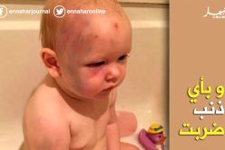 بالصور.. صبي يتعرض للضرب العنيف