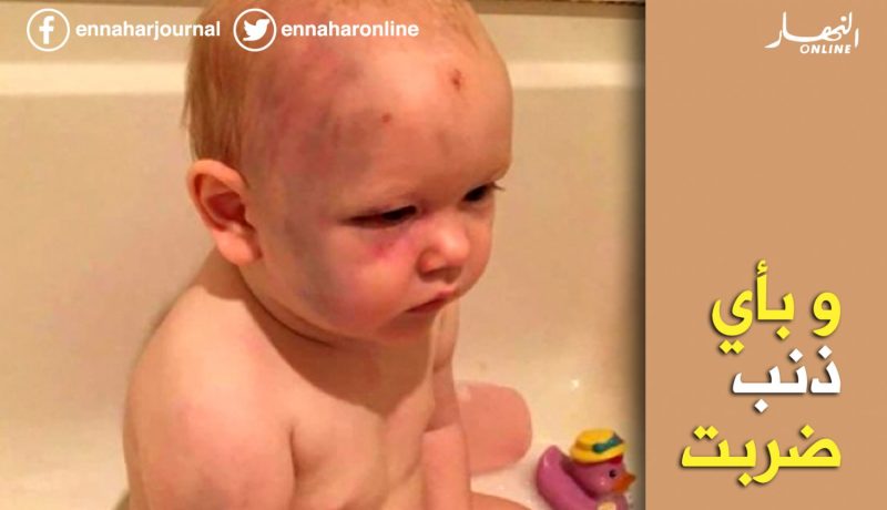 بالصور.. صبي يتعرض للضرب العنيف