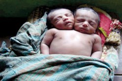 جنين برأسين في‮ ‬رحم والدته بفروحة بمعسكر