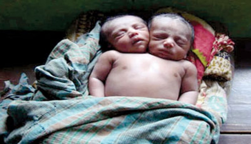 جنين برأسين في‮ ‬رحم والدته بفروحة بمعسكر