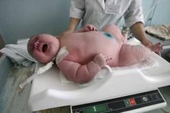 امرأة رومانية تلد طفلة بوزن 7ر6 كيلوغرام و طول 58 سنتيمترا