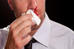 كهل يحطّم أنف محامي  بسبب خلاف حول ركن سيارة بالعاصمة