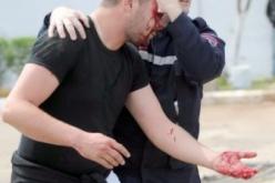 عشرات الجرحى في تدافـع الأنصـار أمـام مدخــــل الملــــعب