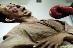 صاحب مطعم‮ ‬يشوّه وجه زبون بلكمات بسبب الديون في‮ ‬وهران