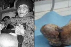 عجوز تضع مولودا في 92 من عمرها