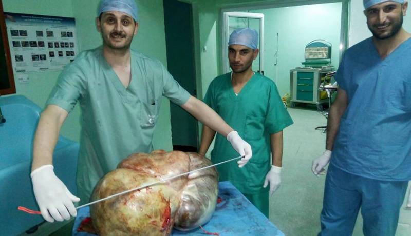 بالصور.. أطباء جزائريون يستأصلون ورما وزنه 37 كلغ من أحشاء امرأة
