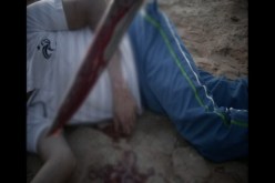 شاب يقطع شرايين يد امرأة خلال مطاردة غريمه بالسكين بسوق سوريكال شرق العاصمة