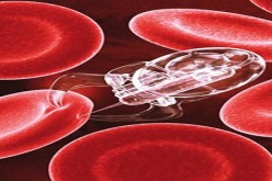 خبراء يتوقعون ارتفاع الإصابة بالسرطان في بريطانيا بحلول2030