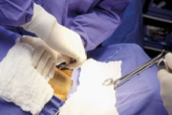 العمليات القيصرية حجة العيادات الخاصة في استغلال جيوب المواطنين