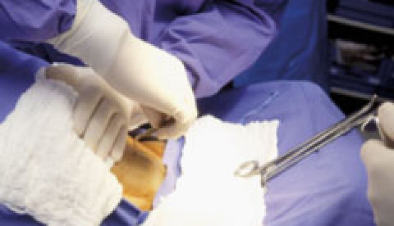 العمليات القيصرية حجة العيادات الخاصة في استغلال جيوب المواطنين