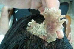 بالصور..هذا ما ستفعله “العقدة” بشعرك