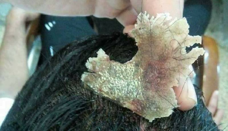 بالصور..هذا ما ستفعله “العقدة” بشعرك