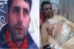شاب يضرم النار في جسمه بمادة البنزين وآخر يخيط فمه بسوق أهراس