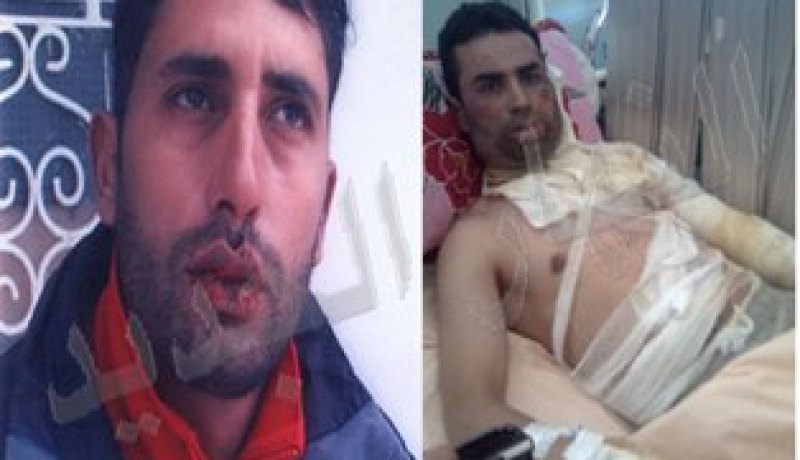 شاب يضرم النار في جسمه بمادة البنزين وآخر يخيط فمه بسوق أهراس
