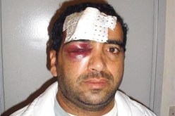 صحفي ''النهار'' يتعرض إلى اعتداءات خطيرة في ملعب بجاية.. في عهــد ''هـف'' روراوة