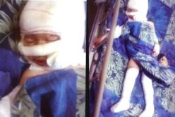 وفاة الصغيرة ''مروى'' أمس بعيادة خاصة بالعاصمة متأثرة بحروقها