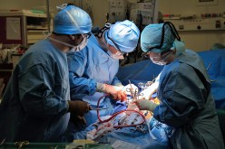تمديد عمل قاعات الجراحة إلى المساء لتقليل البعثات للخارج