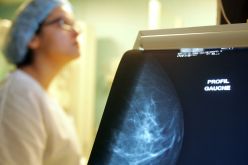 12 ألف حالة جديدة لسرطان الثدي سنويا بالجزائر