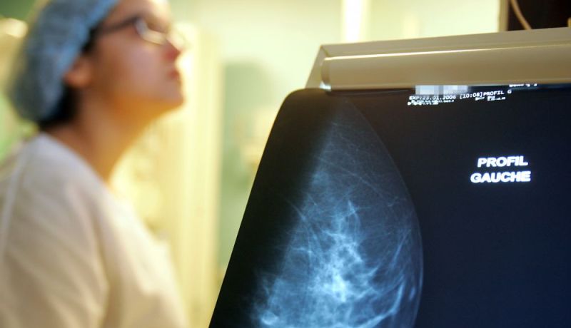 12 ألف حالة جديدة لسرطان الثدي سنويا بالجزائر