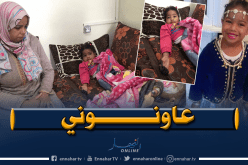طفلة مهددة ببتر أطرافها بسبب مرض نادر في وهران
