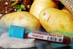 تجار يلهبون الأسعار.. والبطاطا بـ 110 دج بسوق الجملة