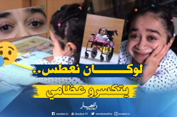صابرينال..معاناة فتاة ولدت بعظام كالزجاج