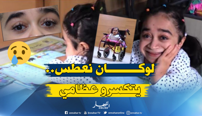 صابرينال..معاناة فتاة ولدت بعظام كالزجاج