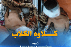 بالصور.. كلاب ضالة تنهش جسد طفل ببلدية الفيض في بسكرة
