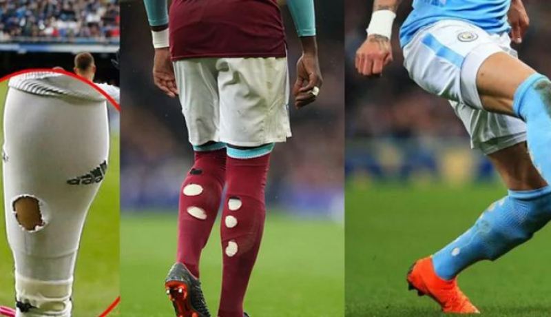 الجَوارب المُمزّقة.. “موضة جديدة” في الملاعب الأوروبية !