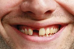 شيخ‮ ‬يهشم أسنان زوجته بعدما شكته إلى عائلته في‮ ‬العاصمة‮ ‬