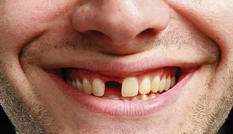 شيخ‮ ‬يهشم أسنان زوجته بعدما شكته إلى عائلته في‮ ‬العاصمة‮ ‬