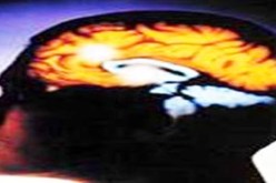 دراسة جديدة تكشف ان مركز النطق في الدماغ غير المكان المحدد سابقا