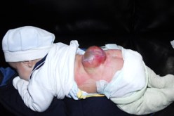 ولد بمرض خطير في أسفل الظهر : الرضيع “أيوب” يواجه الموت و يناشد ذوي القلوب الرحيمة لإنقاذه