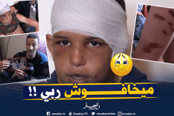 يتيم “حرقوه بالشّاليمو” و”عذّبوه” إخوته من أبيه في قسنطينة