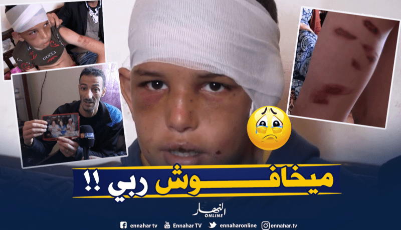 يتيم “حرقوه بالشّاليمو” و”عذّبوه” إخوته من أبيه في قسنطينة