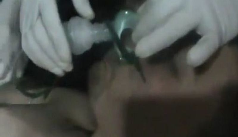 إسرائيل تشكك في تقارير عن استخدام الجيش السوري غازات سامة