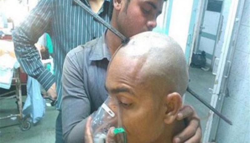 قضيب حديدي يخترق جمجمته لكنه يبقى على قيد الحياة