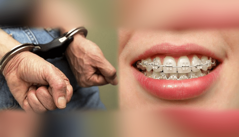 توقيف شخصين أجنبيين بتهمة تركيب الأسنان دون رخصة في بسكرة