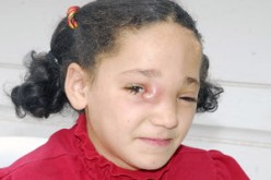 العائلة  تناشد ذوي القلوب الرحيمة إنقاذها من الموت : 7 سنوات ونور الهدى تصارع المرض عقب سقوطها من الطابق الثاني