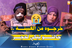 عامل نظافة لمدة 15 سنة .. يعاني من سرطان شوه وجهه بالكامل