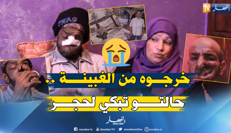 عامل نظافة لمدة 15 سنة .. يعاني من سرطان شوه وجهه بالكامل