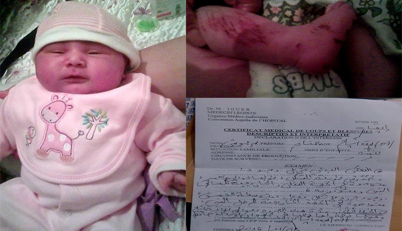 أب يقاضـي مستشفى بسبب تعرض رضيعته إلى خدوش وعضات حيوان مجهول في تبسة