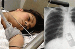 فتاة تبتلع هاتفها النقال خوفا من كشف خيانتها