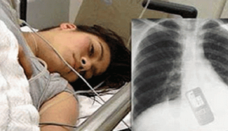 فتاة تبتلع هاتفها النقال خوفا من كشف خيانتها