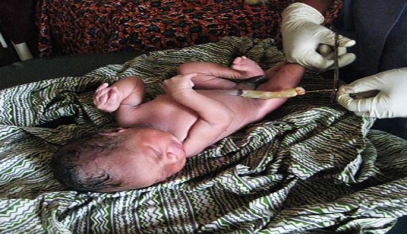 أبحاث لاستخدام خلايا من الحبل السري لمعالجة صمم الرضع