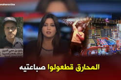 “المحارق” تتسبب في قطع أصابع طفل بالرويبة