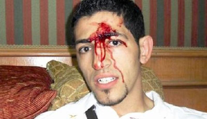 نقابة المحامين الجزائريين تهدد بالإنسحاب من الإتحاد العربي إن لم يقدم المصريون اعتذارهم