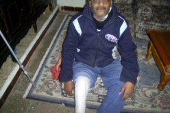 “مراحي”: بترت ساقه اليسرى بعد إصابته بأمراض مزمنة ينتظر التفاتة من السلطات