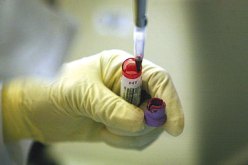 أستراليا تقدم فحصا جديدا لقياس خصوبة المرأة